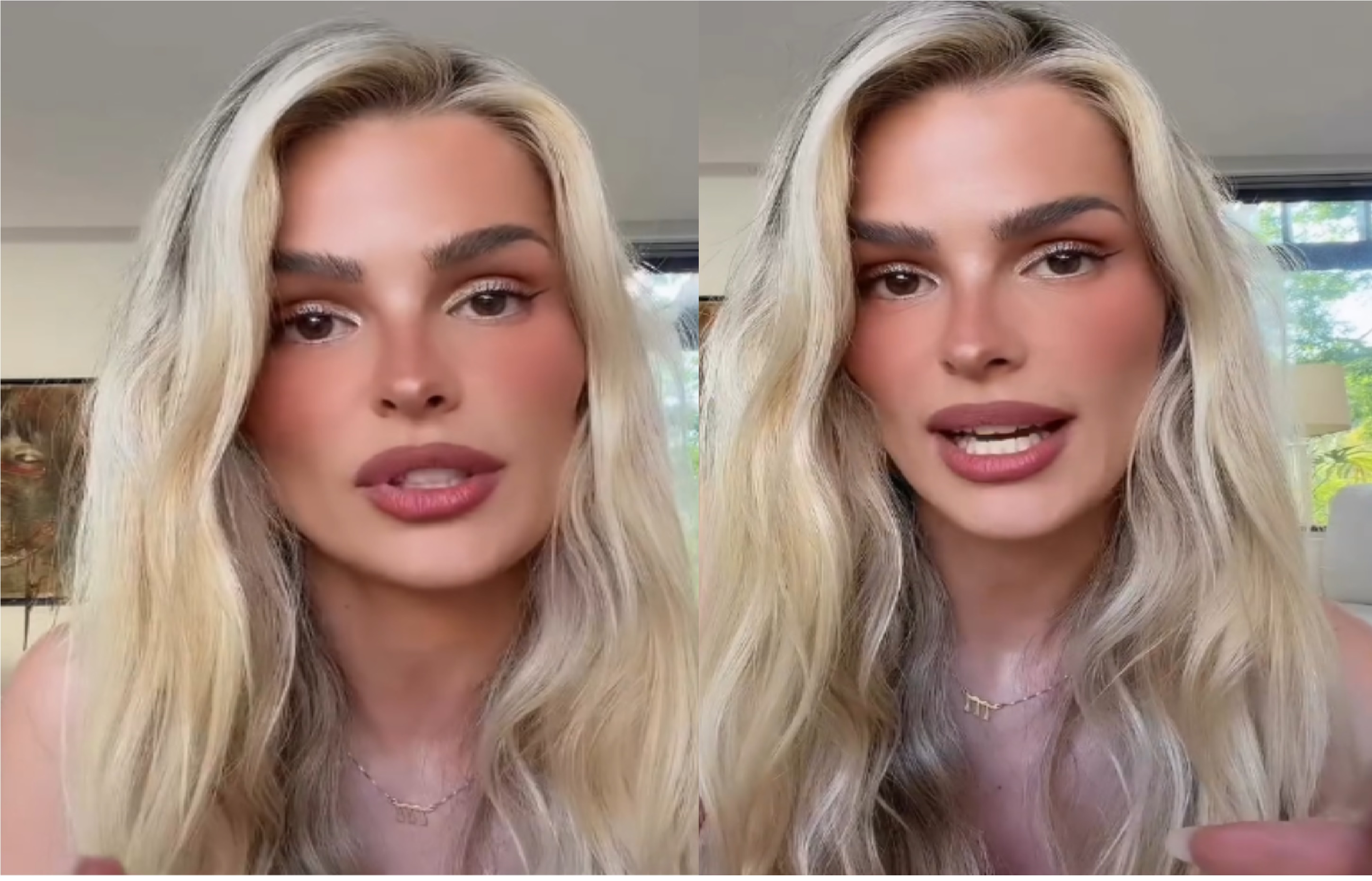 Yasmin Brunet revela detalhes de luta contra depressão e fala sobre momentos mais difíceis